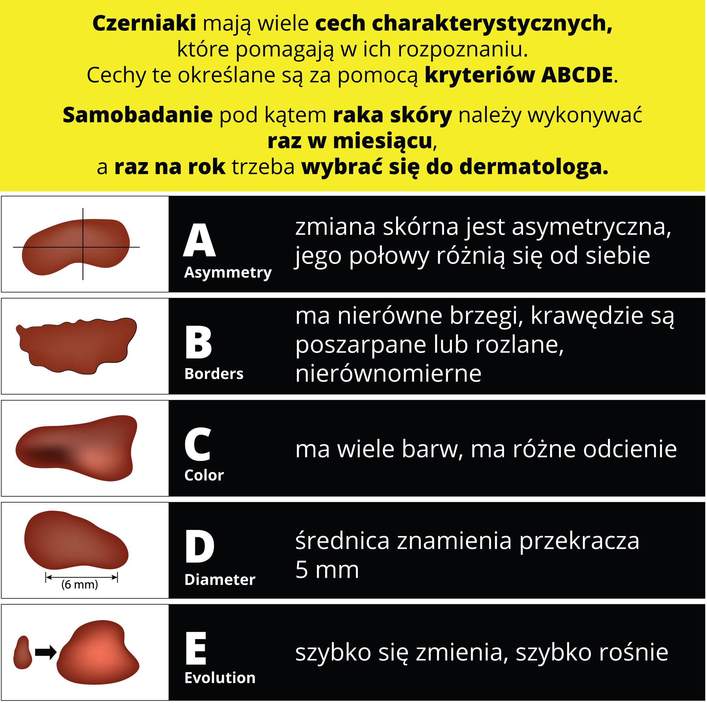 ABCDE rak skory VeritaMed dermatoskopia .jpg
